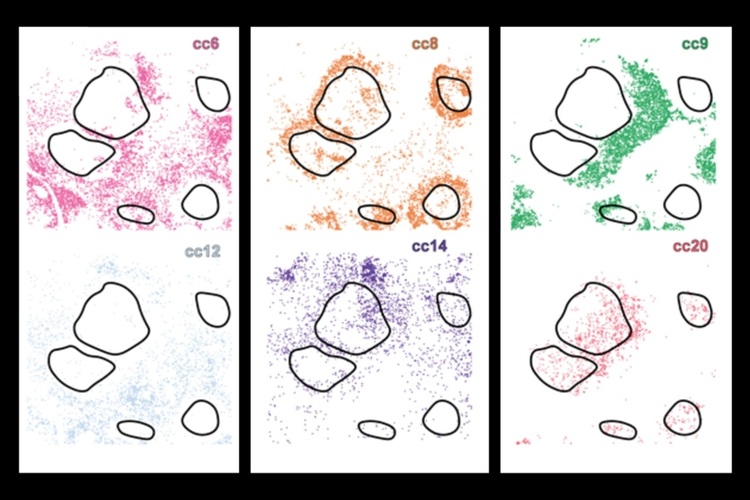 Image: CellLENS enables the potential precision therapy strategies against specific immune cell populations in the tissue environment (Photo courtesy of MIT)